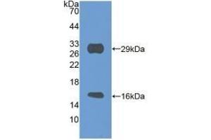 Detection of Recombinant SIRT3, Mouse using Polyclonal Antibody to Sirtuin 3 (SIRT3) (SIRT3 anticorps  (AA 5-257))