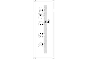 Mouse Plau Antibody (C-term) (ABIN1881658 and ABIN2843214) western blot analysis in human placenta tissue lysates (35 μg/lane). (PLAU anticorps  (C-Term))