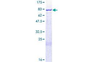 Image no. 1 for Pyruvate Kinase, Liver and RBC (PKLR) (AA 1-574) protein (GST tag) (ABIN1315223)