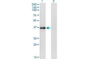 Western Blot analysis of STX12 expression in transfected 293T cell line by STX12 monoclonal antibody (M01), clone 3B9. (Syntaxin 12 anticorps  (AA 108-206))
