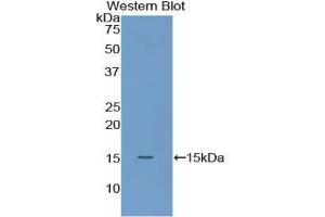 Western blot analysis of the recombinant protein. (S100A9 anticorps  (AA 1-113))