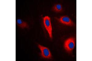 Immunofluorescent analysis of Cytokeratin 16 staining in HeLa cells.