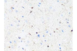 Immunohistochemistry of paraffin-embedded rat brain using TH Antibody (ABIN5974878) at dilution of 1/100 (40x lens). (TH anticorps)