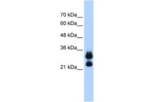 Western Blotting (WB) image for anti-Histone Cluster 1, H1c (HIST1H1C) antibody (ABIN2462944) (HIST1H1C anticorps)