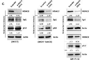 HDAC2 positively regulates the expression of Sp1 and negatively regulates the expression of p53 in ER+ breast cancer cells.