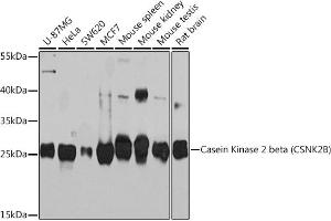 Western blot analysis of extracts of various cell lines, using Casein Kinase 2 beta (Casein Kinase 2 beta (CSNK2B)) Rabbit pAb (ABIN7266104) at 1:1000 dilution.