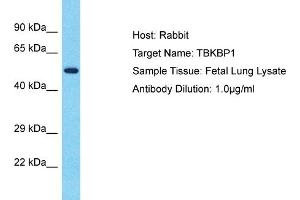 Host: Rabbit Target Name: TBKBP1 Sample Type: Fetal Lung lysates Antibody Dilution: 1. (TBKBP1 anticorps  (N-Term))