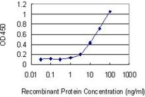 Detection limit for recombinant GST tagged KLK1 is 0. (Kallikrein 1 anticorps  (AA 168-262))