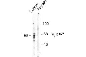 Image no. 1 for anti-Microtubule-Associated Protein tau (MAPT) (pSer416) antibody (ABIN372727) (MAPT anticorps  (pSer416))