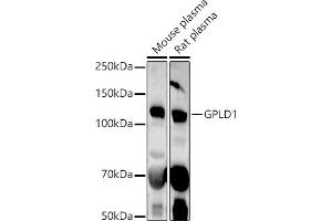 Western blot analysis of extracts of various cell lines, using GPLD1 antibody (ABIN6131716, ABIN6141335, ABIN6141336 and ABIN6222300) at 1:1000 dilution. (GPLD1 anticorps  (AA 24-160))