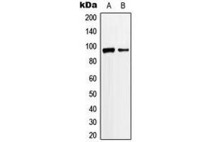 Western blot analysis of ANKRD20A3 expression in Jurkat (A), K562 (B) whole cell lysates. (ANKRD20A3 anticorps  (Center))