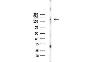 anti-Splicing Factor, Arginine/serine-Rich 14 (SFRS14) (Internal Region) antibody