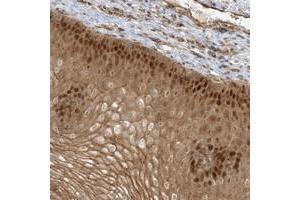 Immunohistochemical staining of human esophagus with NAF1 polyclonal antibody  shows strong nuclear and cytoplasmic positivity in squamous epithelial cells at 1:50-1:200 dilution. (NAF1 anticorps)