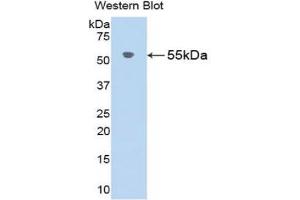 Detection of Recombinant AGT, Rat using Polyclonal Antibody to Angiotensinogen (AGT)