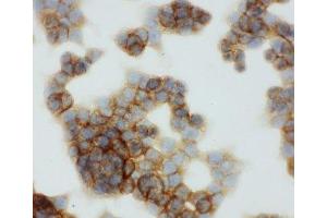 ICC testing of HCT116 cell