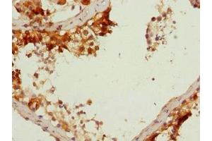 Immunohistochemistry of paraffin-embedded human testis tissue using ABIN7149639 at dilution of 1:100 (DAZ2 anticorps  (AA 1-200))