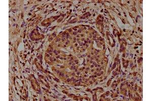 anti-CAP, Adenylate Cyclase-Associated Protein 1 (CAP1) (AA 22-157) antibody