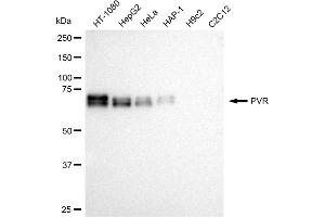 Western blotting analysis using PVR antibody (ABIN7799862).