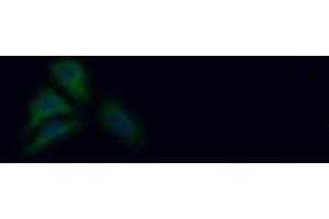 Detection of PKLR in Human HepG2 cell using Polyclonal Antibody to Pyruvate kinase isozymes R/L (PKLR)