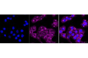 anti-phospholipid Scramblase 1 (PLSCR1) antibody