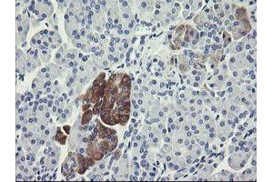 Image no. 3 for anti-Formiminotransferase Cyclodeaminase (FTCD) antibody (ABIN1496378)