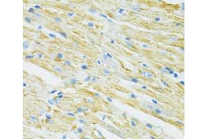 Immunohistochemistry of paraffin-embedded Mouse heart using SLC19A1 Polyclonal Antibody at dilution of 1:100 (40x lens). (SLC19A1 anticorps)