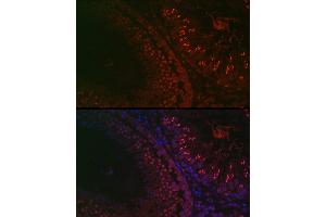 Immunofluorescence analysis of rat testis using DAZL Rabbit pAb (ABIN6130243, ABIN6139416, ABIN6139417 and ABIN6218163) at dilution of 1:100 (40x lens).