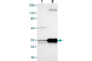Western blot analysis of Lane 1: Human cell line RT-4, Lane 2: Human cell line U-251MG sp with ECH1 polyclonal antibody . (ECH1 anticorps)