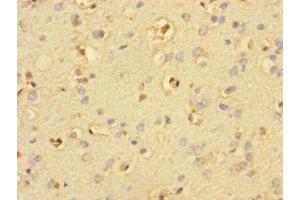 Immunohistochemistry of paraffin-embedded human brain tissue using ABIN7169856 at dilution of 1:100 (SMIM19 anticorps  (AA 44-107))