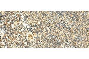 Immunohistochemistry of paraffin-embedded Human tonsil tissue using ATP5PD Polyclonal Antibody at dilution of 1:50(x200)