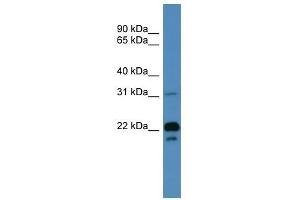 BASP1 antibody used at 0. (BASP1 anticorps  (N-Term))