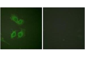 Immunofluorescence analysis of HeLa cells, using Amyloid beta A4 (Ab-743/668) Antibody. (APP anticorps  (AA 711-760))