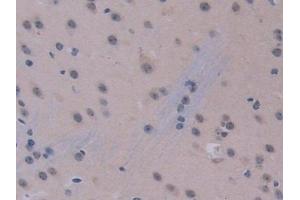 Detection of IL12A in Mouse Cerebrum Tissue using Polyclonal Antibody to Interleukin 12A (IL12A)