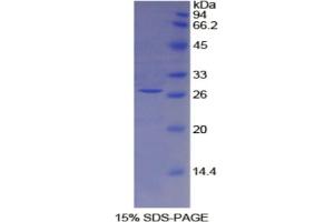 SDS-PAGE analysis of Mouse TFPI2 Protein. (TFPI2 Protéine)