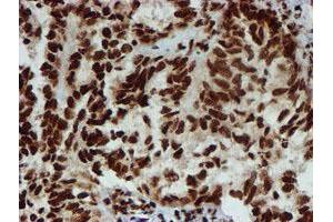 Image no. 5 for anti-Peptidyl Arginine Deiminase, Type IV (PADI4) antibody (ABIN1500017)