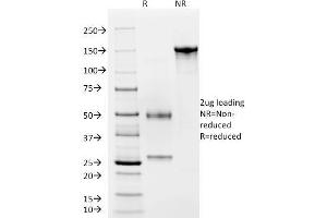SDS-PAGE Analysis Purified CD4 Mouse Monoclonal Antibody (C4/206). (CD4 anticorps)