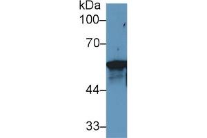 Western Blot; Sample: Human MCF7 cell lysate; Primary Ab: 1µg/ml Rabbit Anti-Rat KRT6A Antibody Second Ab: 0.