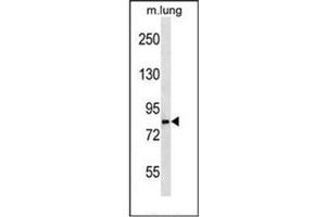 Western blot analysis of LRSAM1 Antibody
