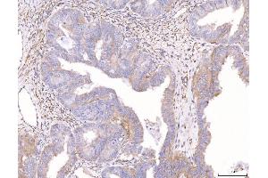 IHC analysis of ENPP1/PC1 using anti-ENPP1/PC1 antibody (ABIN7601410). (ENPP1 anticorps  (AA 347-789))