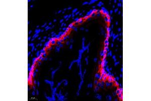 Immunofluorescent analysis of paraffin embedded rat stomcah using CK6 (ABIN7074423) at dilution of 1: 2000 (Keratin 6 anticorps)