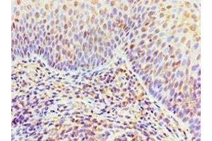 Immunohistochemistry of paraffin-embedded human tonsil tissue using ABIN7156454 at dilution of 1:100 (ITGA9 anticorps  (AA 30-250))