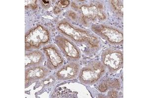 Immunohistochemical staining of human kidney shows moderate cytoplasmic and membranous positivity in cells in tubules. (IL1R1 anticorps)