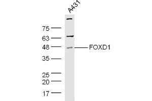 Human A431 cell lysates probed with Rabbit Anti-Pan FOXD Polyclonal Antibody, Unconjugated  at 1:500 for 90 min at 37˚C. (FOXD (AA 131-230) anticorps)