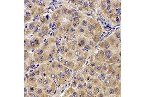 Immunohistochemical analysis of Complement C7 staining in human liver formalin fixed paraffin embedded tissue section. (C7 anticorps  (N-Term))