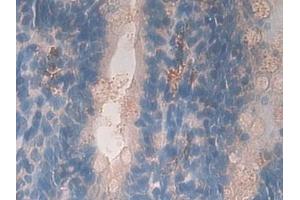 Detection of GHR in Rat Small intestine Tissue using Polyclonal Antibody to Growth Hormone Receptor (GHR)