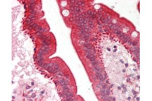 Human Small Intestine: Formalin-Fixed, Paraffin-Embedded (FFPE).