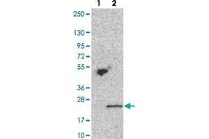 Western blot analysis of Lane 1: Negative control (vector only transfected HEK293T lysate). (TMEM69 anticorps)