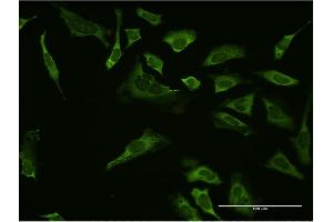 Immunofluorescence of monoclonal antibody to SP1 on HeLa cell.