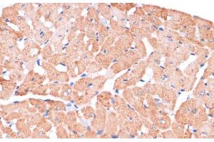 Immunohistochemistry of paraffin-embedded Rat heart using DVL2 Polyclonal Antibody at dilution of 1:100 (40x lens). (DVL2 anticorps)