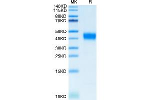 Cynomolgus CD38 on Tris-Bis PAGE under reduced condition. (CD38 Protein (AA 44-301) (His tag))